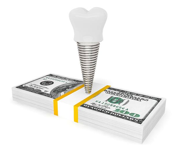 Dental implant on a pile of money