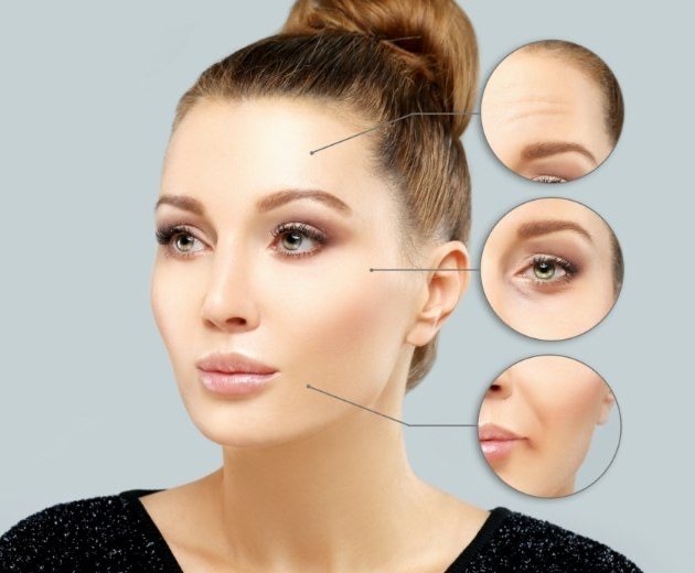 Face of a woman with facial feminization surgery options highlighted