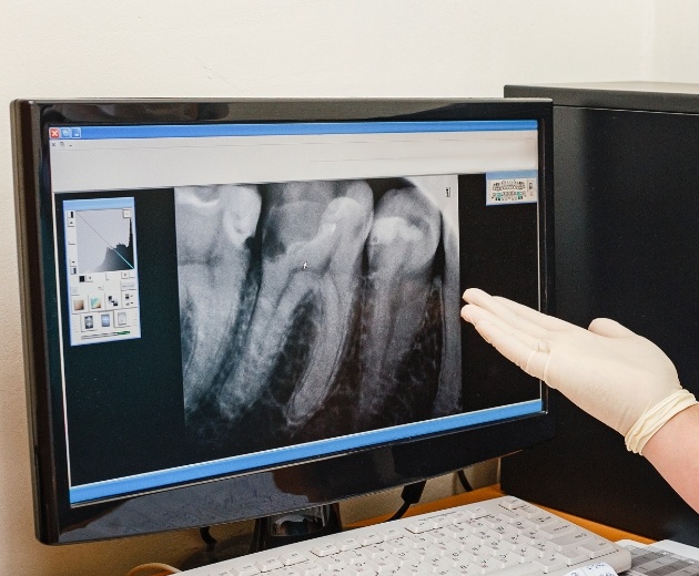 Oral surgeon and patient reviewing digital x rays using advanced oral surgical technology