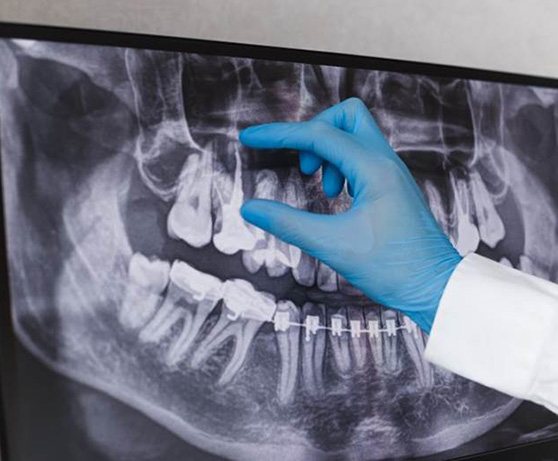 Close-up of smiling man in dental treatment chair